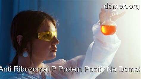 Anti ribozomal p protein negatif ne demek